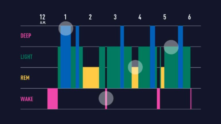 sleep hypnogram